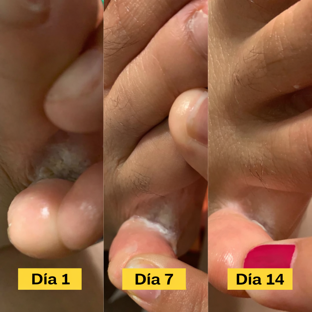 CleanPro Antifungal Soap