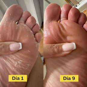 CleanPro Antifungal Soap